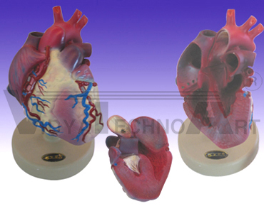 Heart model in atheroscierosis and myocardial hypertrophy